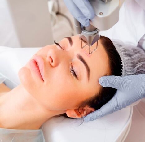 Face laser rejuvenation