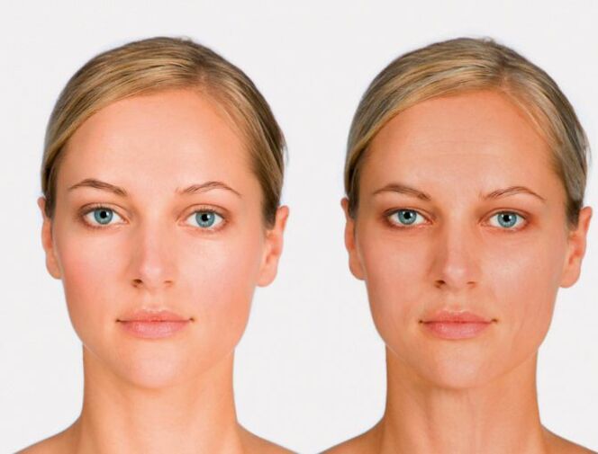 face later and before rejuvenation