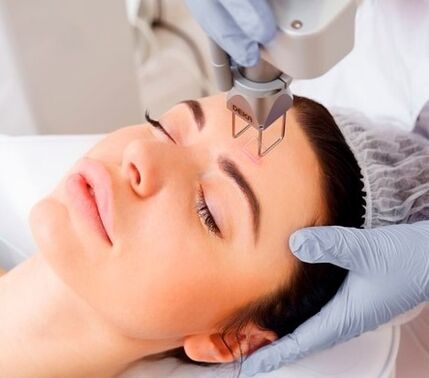 The essence of the facial skin rejuvenation procedure with a fractional laser.