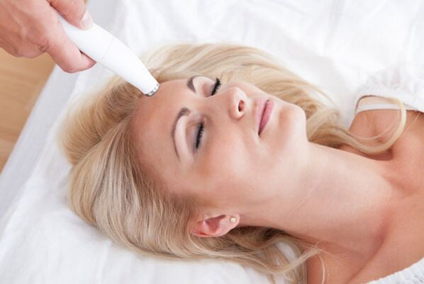 How is fractional laser resurfacing performed