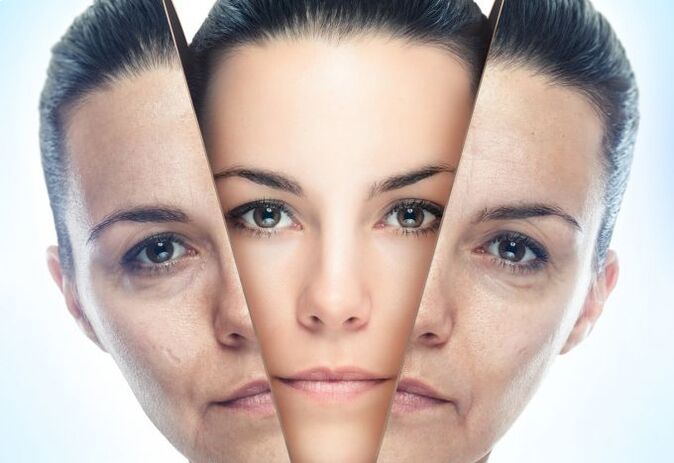 The process of removing facial skin from age-related changes. 